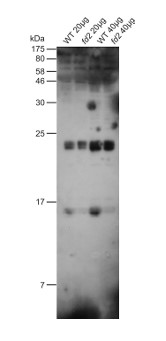 FDX1 | Ferredoxin in the group Antibodies Plant/Algal / Photosynthesis / Electron transfer at Agrisera AB (Antibodies for research) (AS06 121)